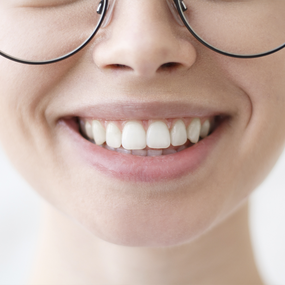 Imagen de una sonrisa de una chica con los dientes blancos
